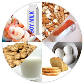 Food Allergy is a rising concern in today's world Food Allergy is a rising concern in today's world
