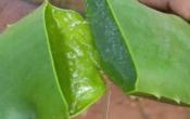 Herbal Remedies For Pityriasis Rosea 