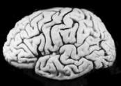 Alcohol Doesn't Kill Brain Cells, Research Suggests