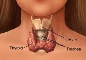 Supplements For Hyperthyroidism