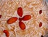 Sweet Vermicelli