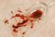How To Remove Red Wine Stains