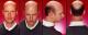 Home Remedies For Baldness