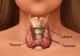 Supplements for Hyperthyroidism