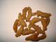 Herbal Remedies For Sarcoidosis