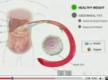 How Insulin Works In The Body