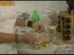 How To Make Easy Fruit Mold