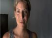 Natural Headache Cures, Ep 263
