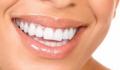 All About Brite Smile Teeth Whitening Video