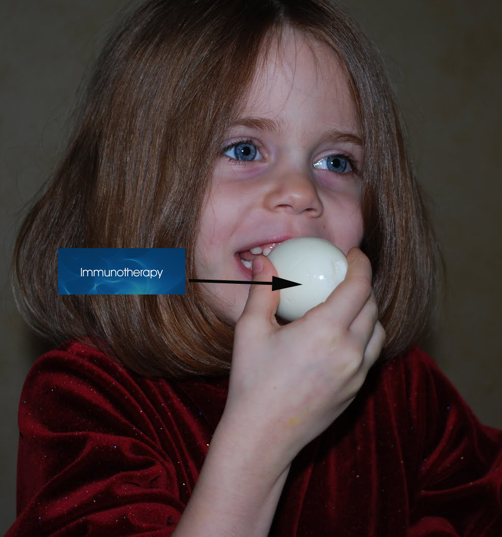 Immunotherapy to cure Food Allergy